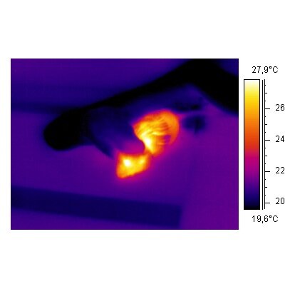 Thermographic snake